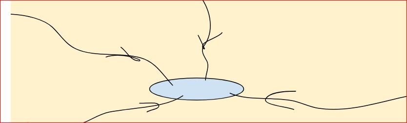 अभिकेंद्रीय अपवाह तंत्र